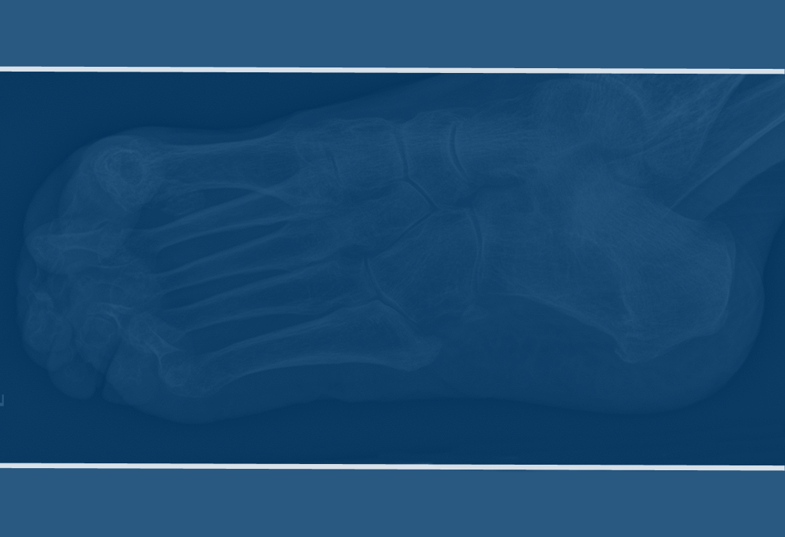 orthopaedic-foot-ankle