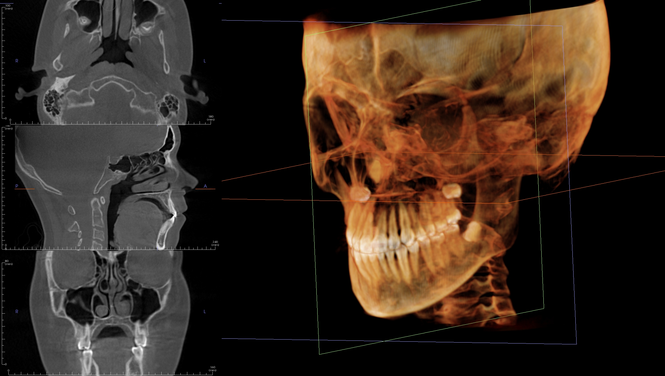 CBCT Volume Oral Radiologists